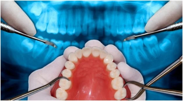 Preparing for the Procedure